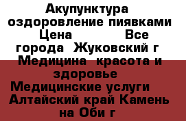 Акупунктура, оздоровление пиявками › Цена ­ 3 000 - Все города, Жуковский г. Медицина, красота и здоровье » Медицинские услуги   . Алтайский край,Камень-на-Оби г.